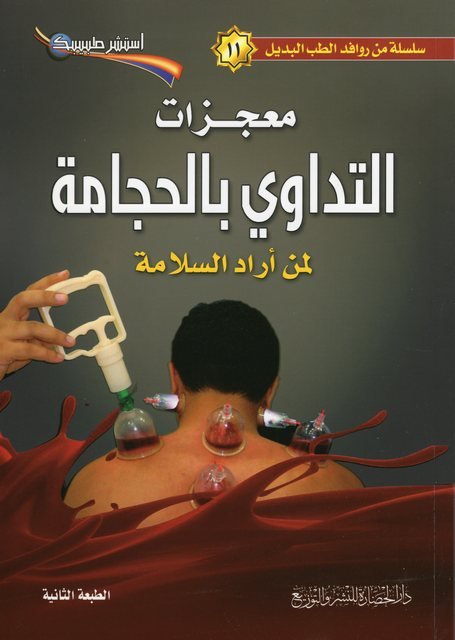 سلسلة من روافد الطب البديل 11 : معجزات التداوي بالحجامة لمن أراد السلامة