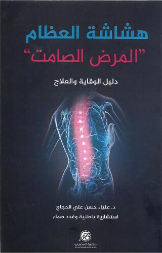 هشاشة العظام : المرض الصامت دليل الوقاية والعلاج