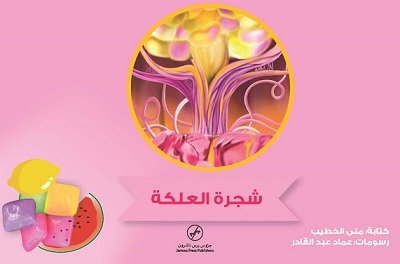 شجرة العلكة