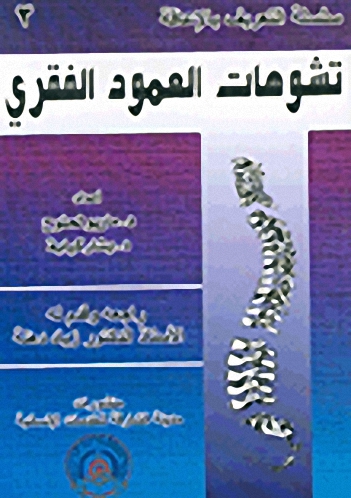 تشوهات العمود الفقري