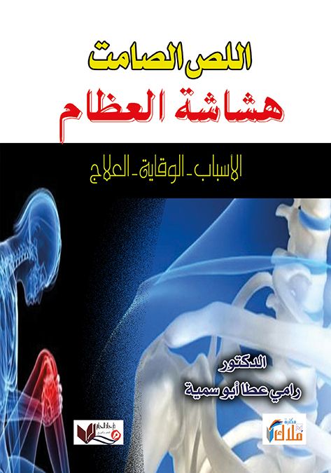 هشاشة العظام - اللص الصامت - الاسباب - الوقاية - العلاج
