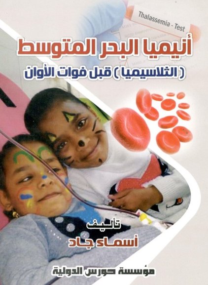 أنيميا البحر المتوسط ( الثلاسيميا ) قبل فوات الأوان